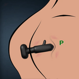 APP Control Butt Plug 9 Tapping 9 Vibrierender Anal Plug Spitzes Design Anal Vibrator Prostata Massagegerät 