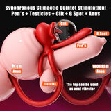 Ethan-Multi-speed Dual Stimulation Ring Set For Couple 10-mode Remote-controlled Penile Sleeve & Clitoral Vibrator